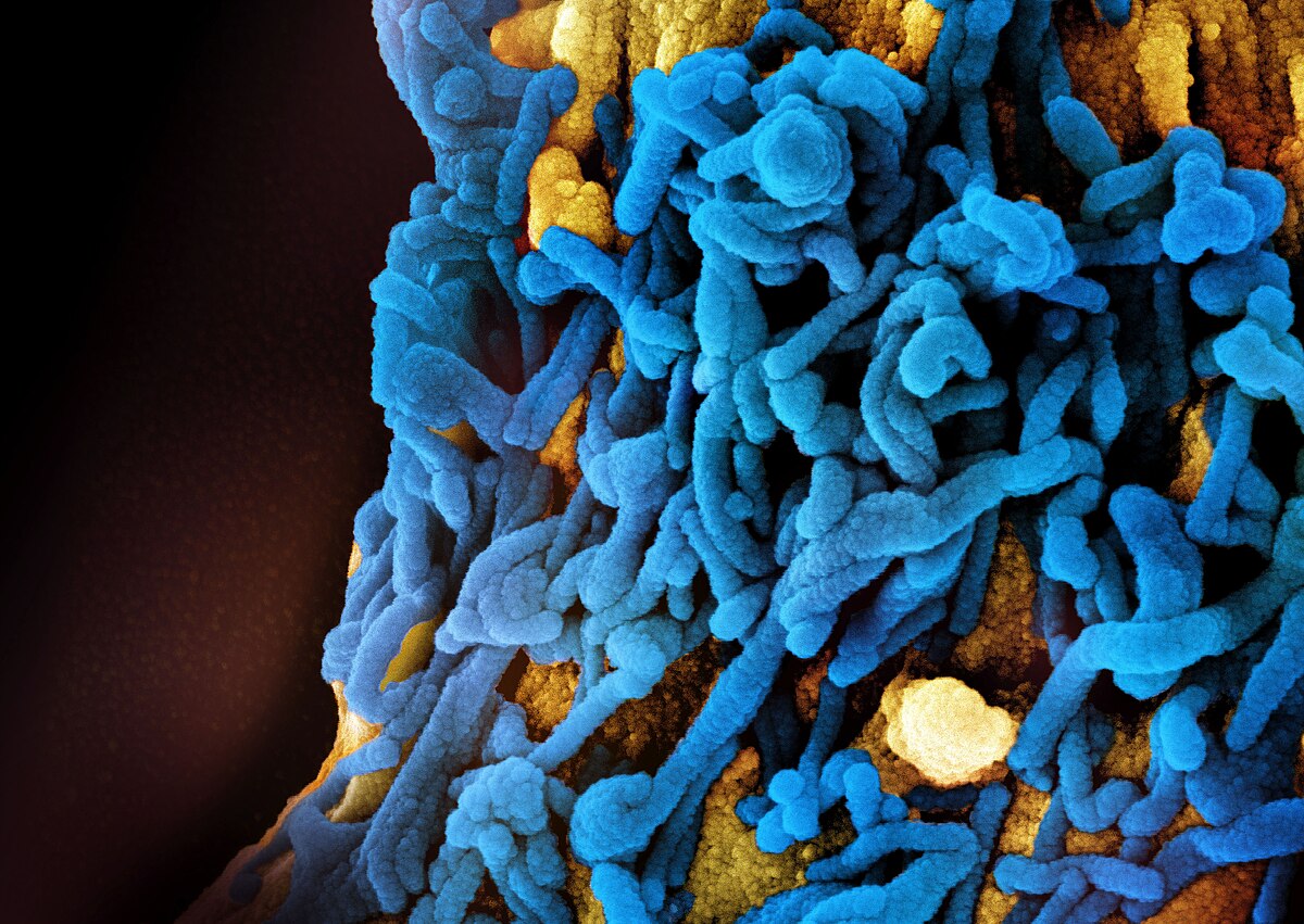 marburg virus outbreak
