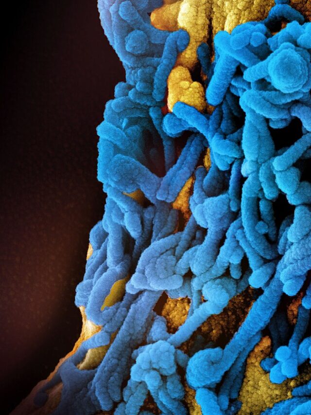 Marburg Virus Outbreak: Key Facts